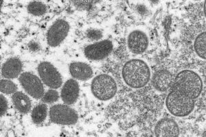 ハワイ州保健局、サル痘感染者をさらに3名確認、合計11名に